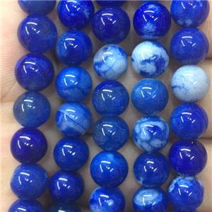 round blue agate beads, approx 8mm dia